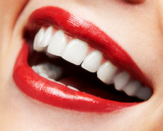 Smile makeover dental