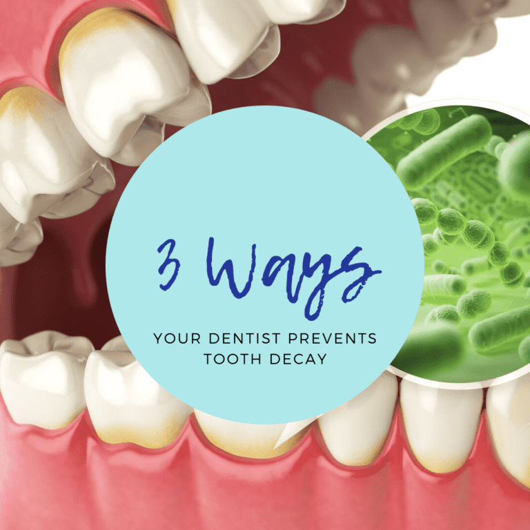 Effective Ways to Prevent Tooth Decay