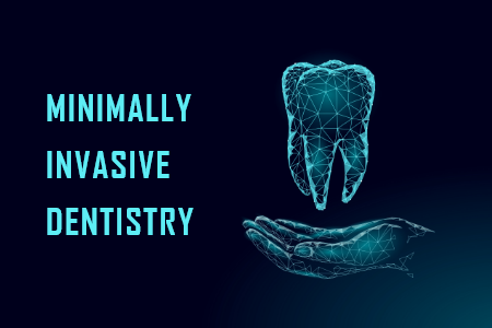 Minimally Invasive Dentistry