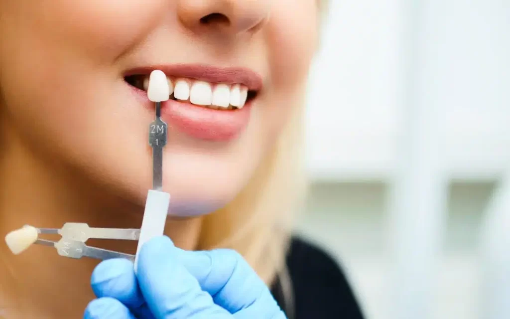 Popular Cosmetic Dentistry Treatments