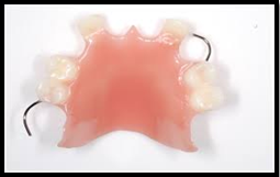 Removable Partial Denture