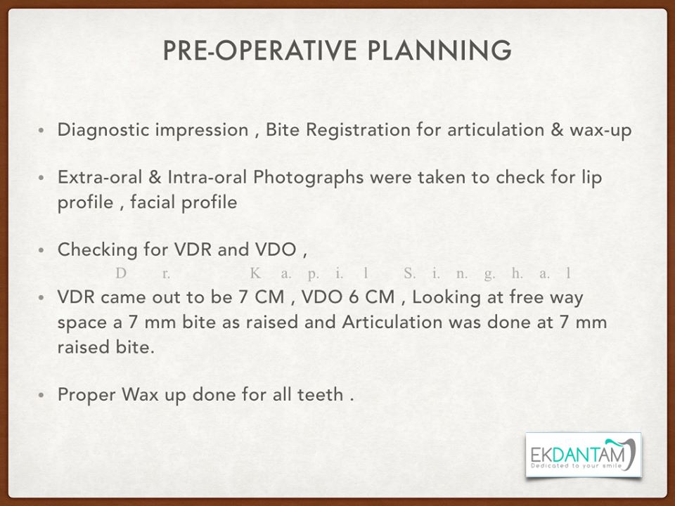 Case profile