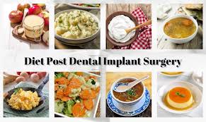 What Foods to Avoid After Dental Implant Surgery