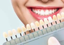 Teeth Whitening Cost in Jaipur